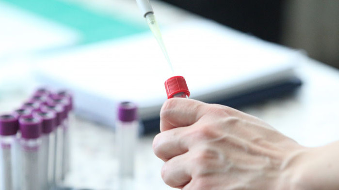 Затвориха сградата на община Сунгурларе заради трима с COVID-19